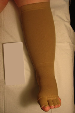 compression boots for lymphedema